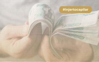 ¿Cuánto cuesta la cirugía capilar?