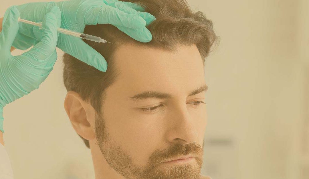 Cómo funciona la mesoterapia capilar