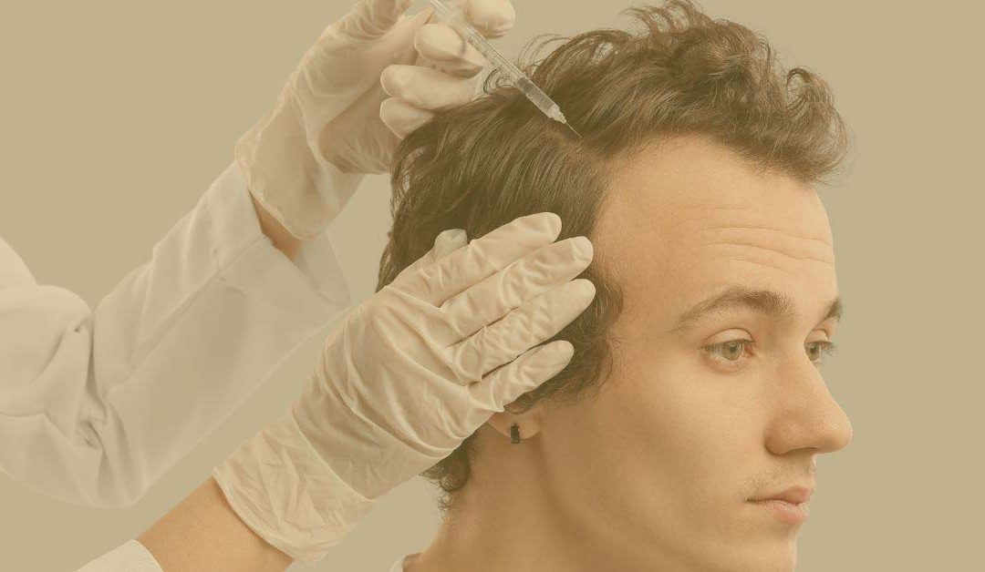 ¿Qué es la mesoterapia capilar?