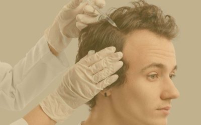 ¿Qué es la mesoterapia capilar?