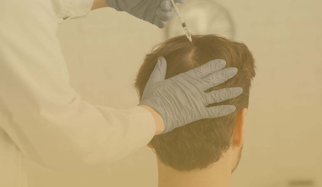 Soluciones de injertos capilares en Madrid Clínica Novamedic el mejor tratamiento para ti