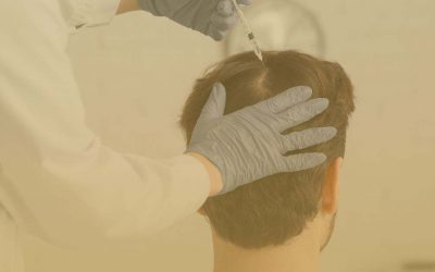 Soluciones de injertos capilares en Madrid Clínica Novamedic el mejor tratamiento para ti