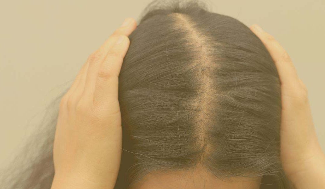 Alopecia Difusa
